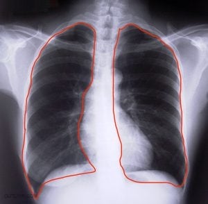 The bottom of the lungs holds more air.