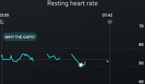 The Oura Ring does not capture data perfectly and consistently.