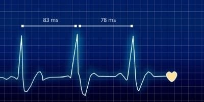 HRV vs HR