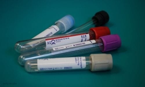 Blood Vials For Blood & Laboratory Health Markers