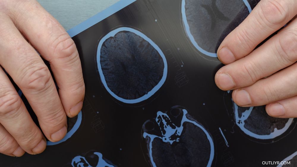 Person holding results of a brain scan